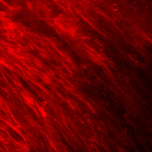 t_myelin_white_matter.jpg
